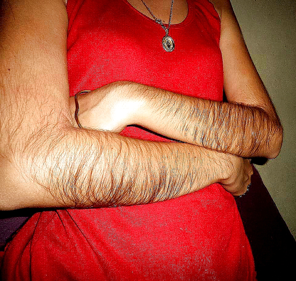 Girl with very hairy arms #23253075