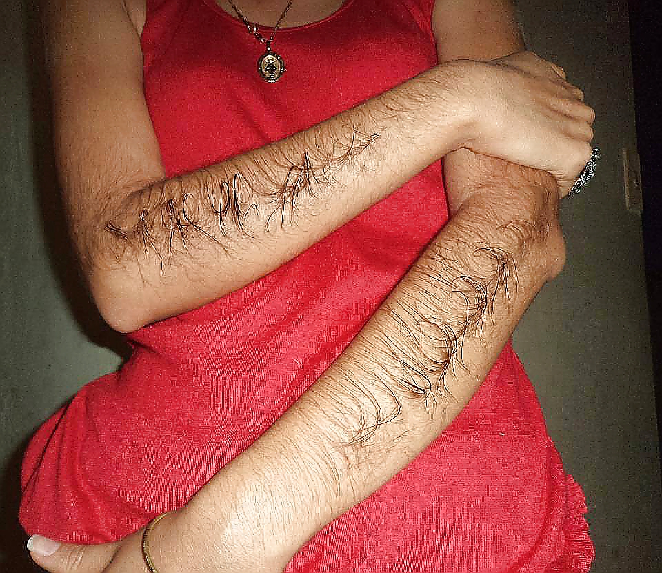 Girl with very hairy arms #23253084