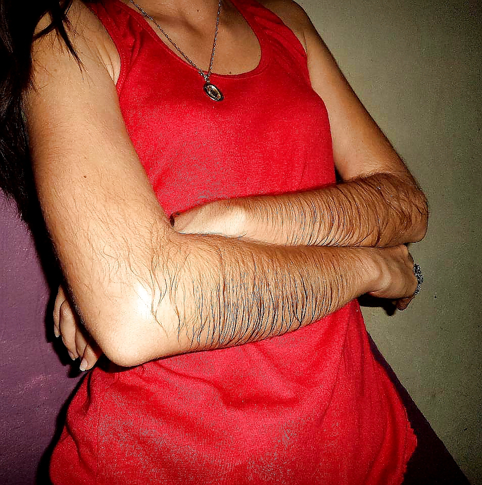 Girl with very hairy arms #23253094