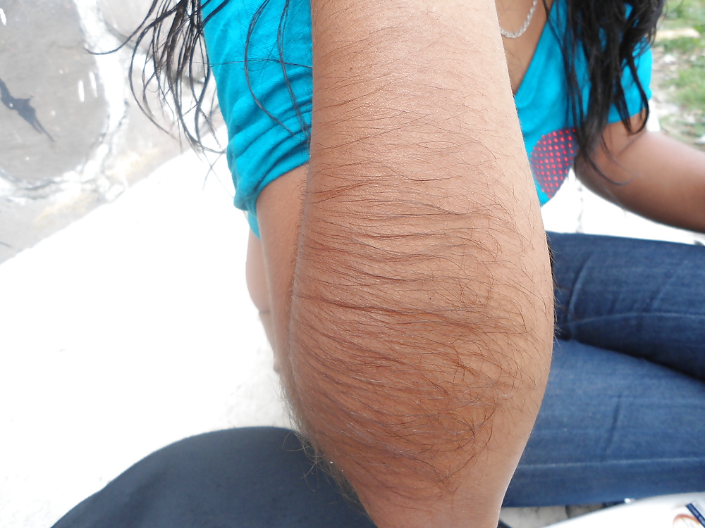 Girl with very hairy arms #23253174