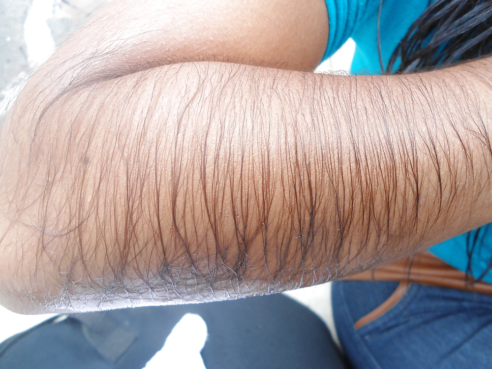 Girl with very hairy arms #23253222