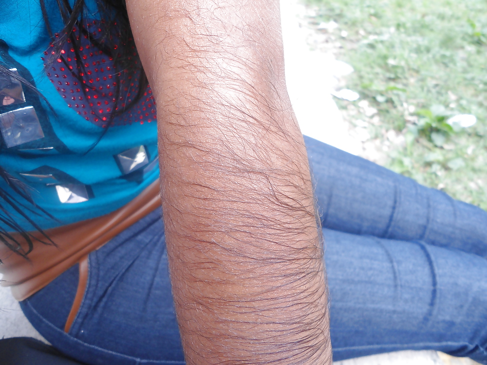 Girl with very hairy arms #23253287
