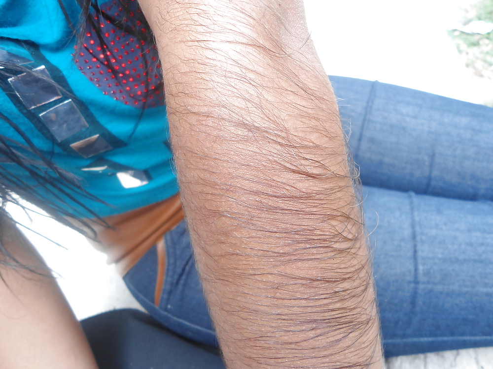 Girl with very hairy arms #23253295