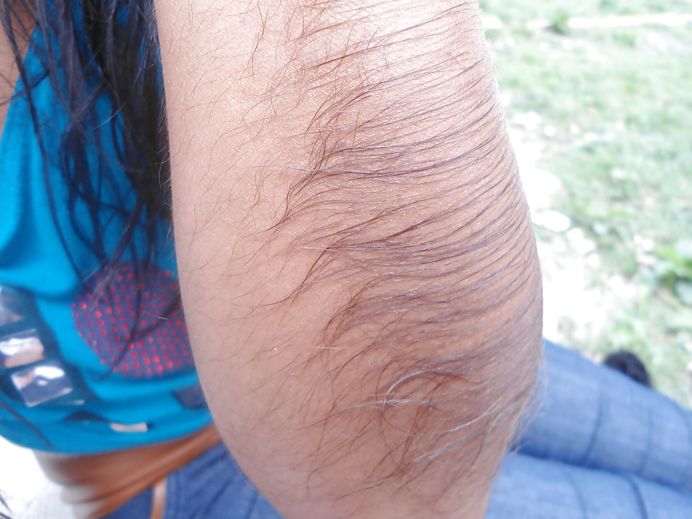 Girl with very hairy arms #23253303