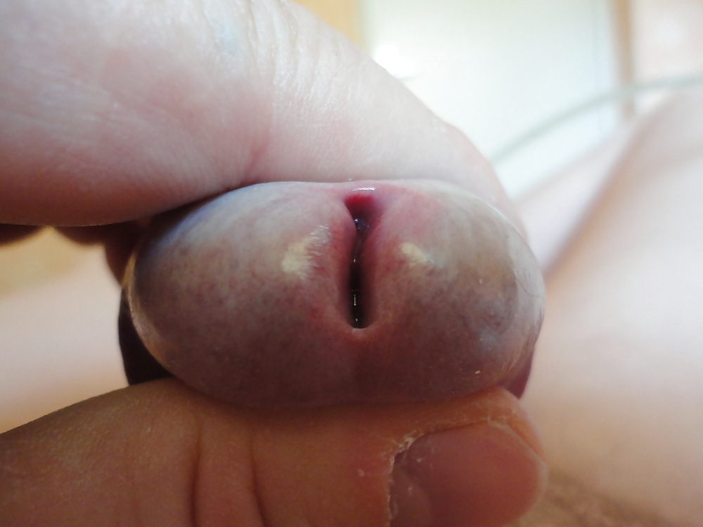 Close up peehole my myin nille glied eichel
 #38883138
