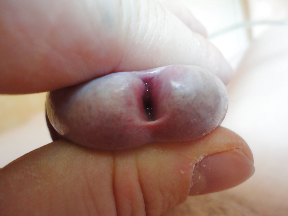 Close Up  Peehole  My Mein Nille Glied Eichel #38883144