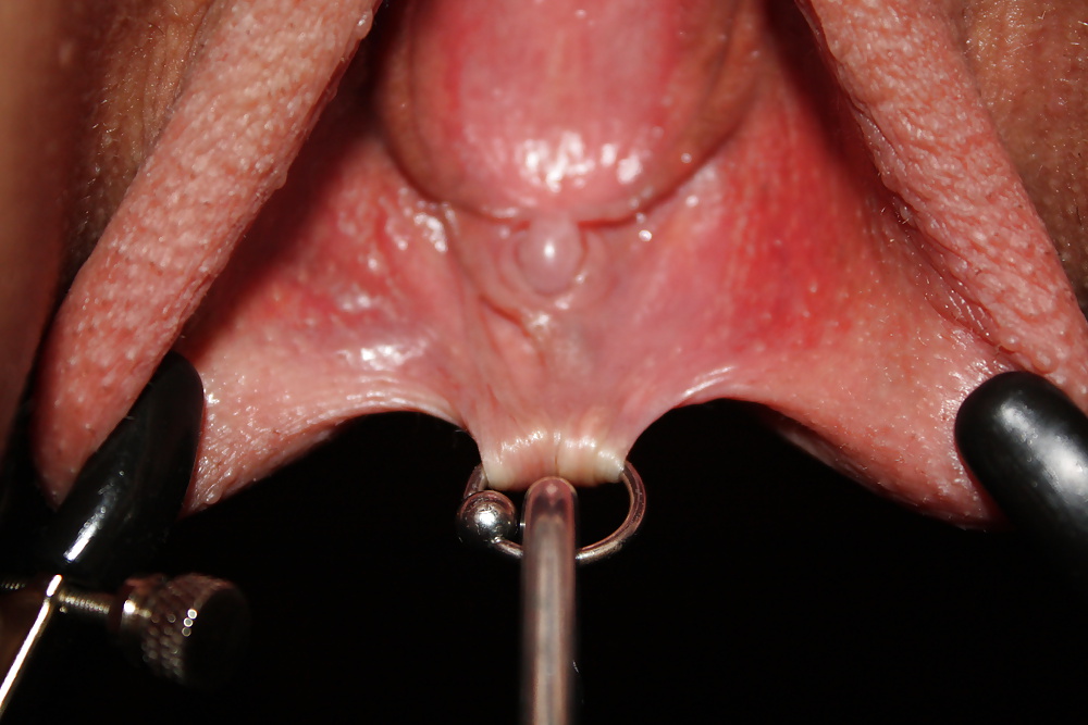 Klemmen & gewichte
 #27998613