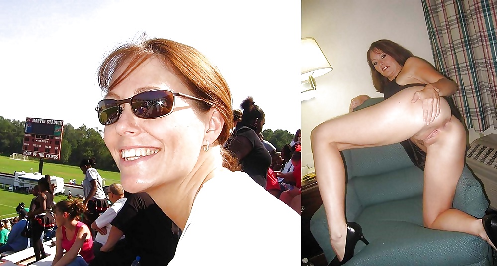 146- BEFORE AND AFTER 1 #26865657