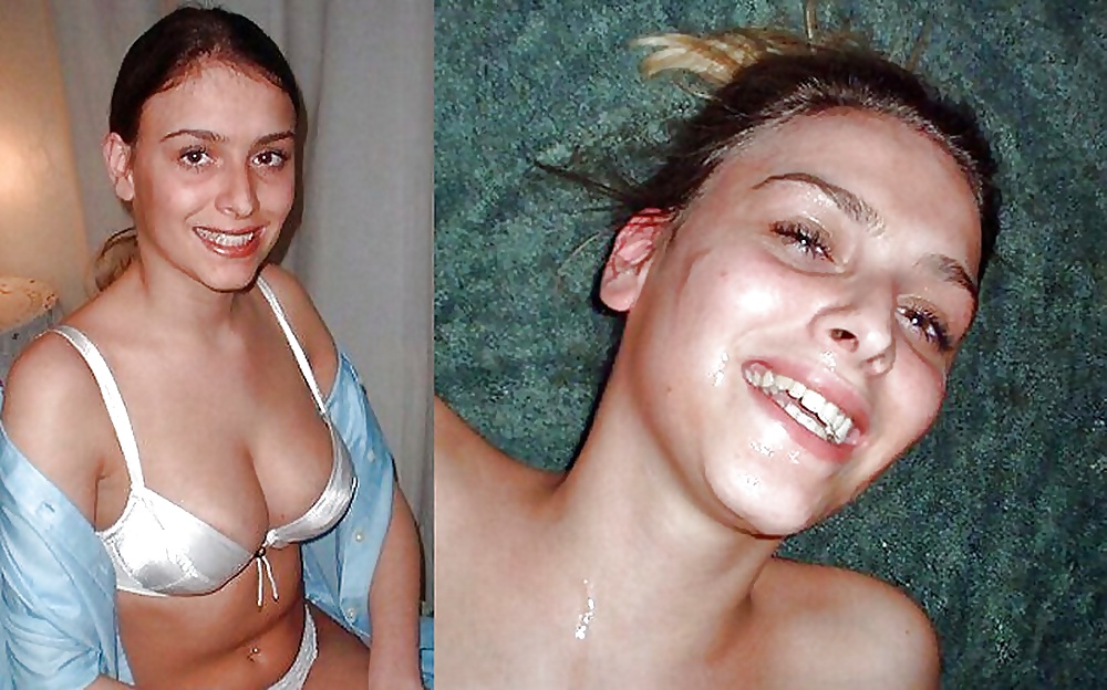 146- BEFORE AND AFTER 1 #26865698