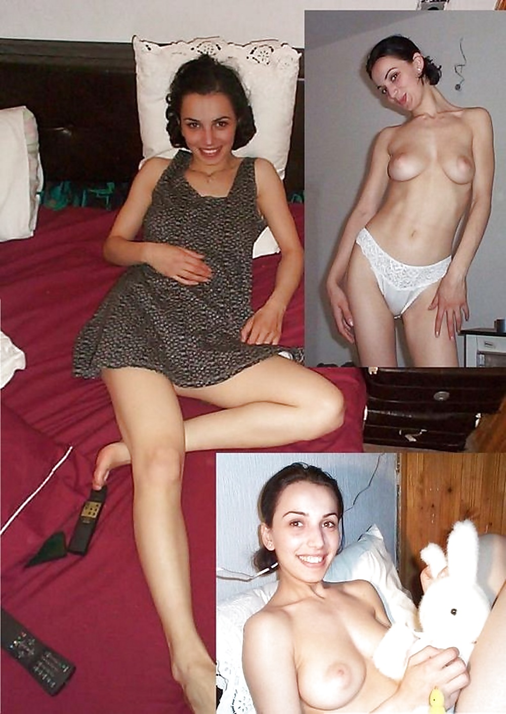 146- BEFORE AND AFTER 1 #26865985