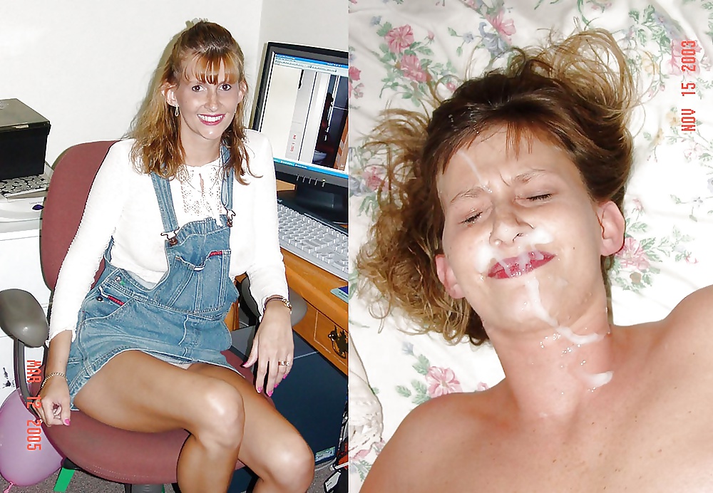 169- BEFORE AND AFTER 9 #30088159