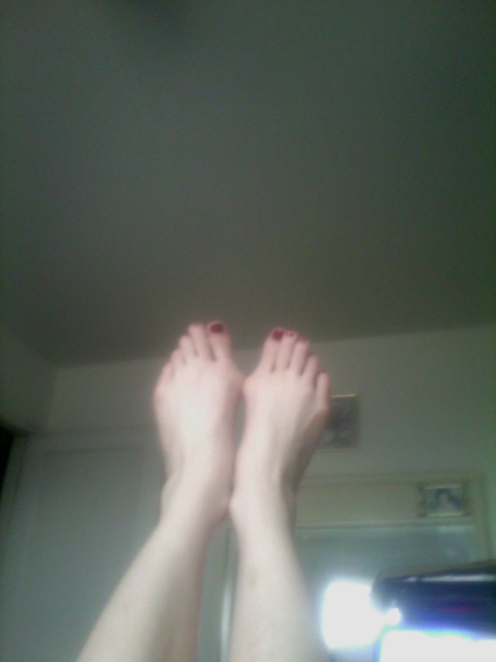 Bunions #37807163