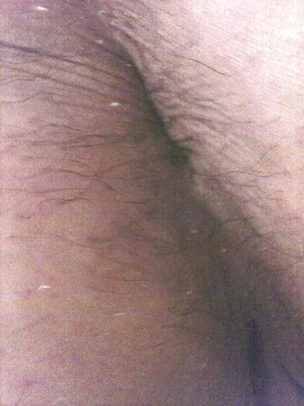 Susan hpv
 #23804905