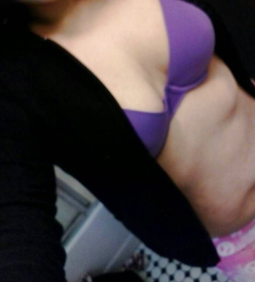 Susan hpv
 #23804938
