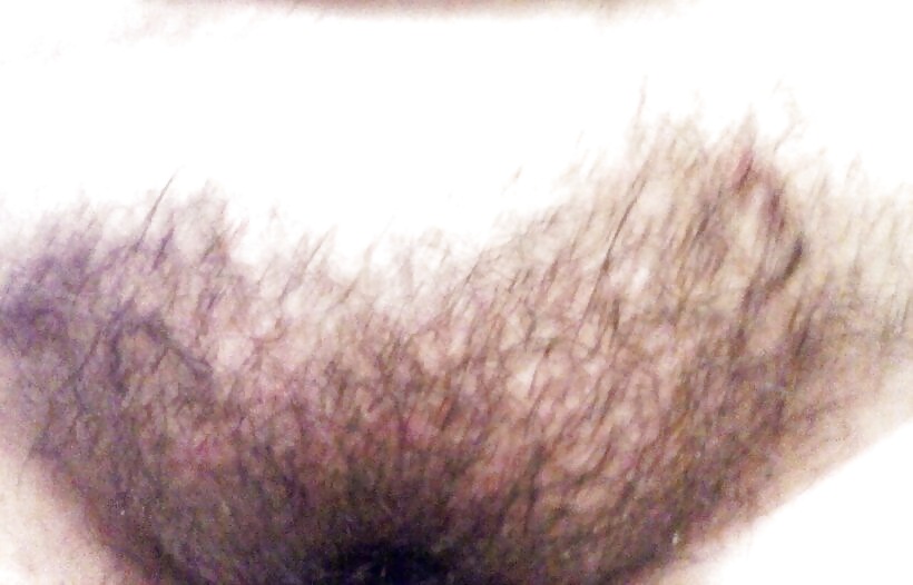 Susan hpv
 #23804964