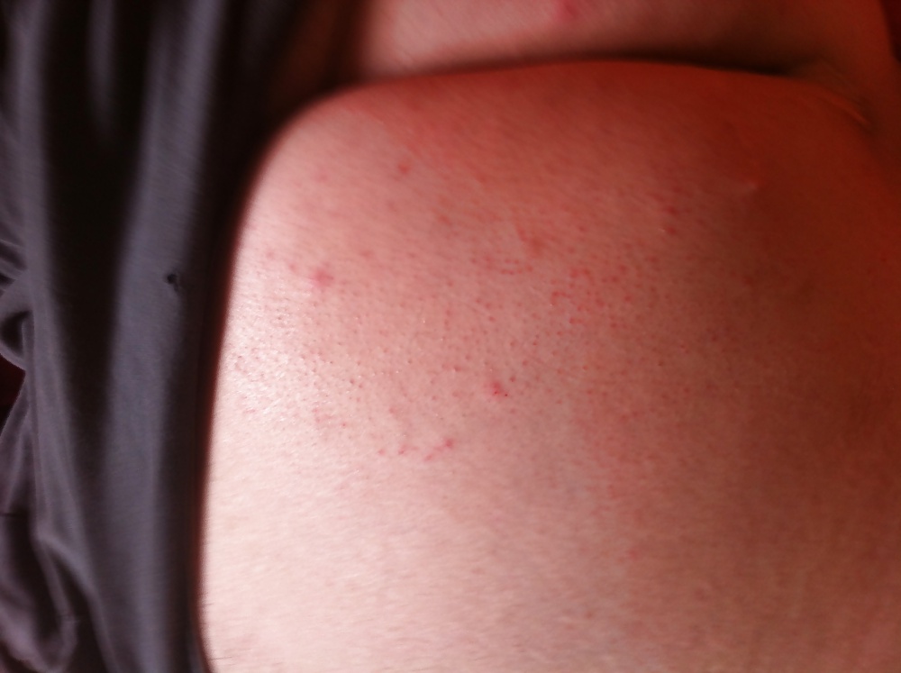 Yine yatakda
 #26371773