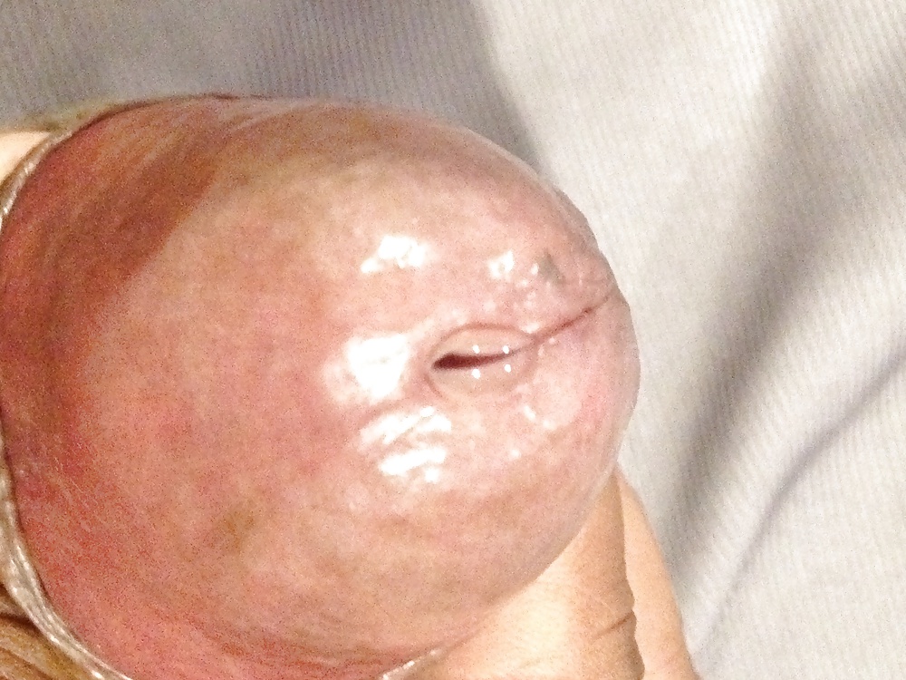 Mallu kunna #38701485