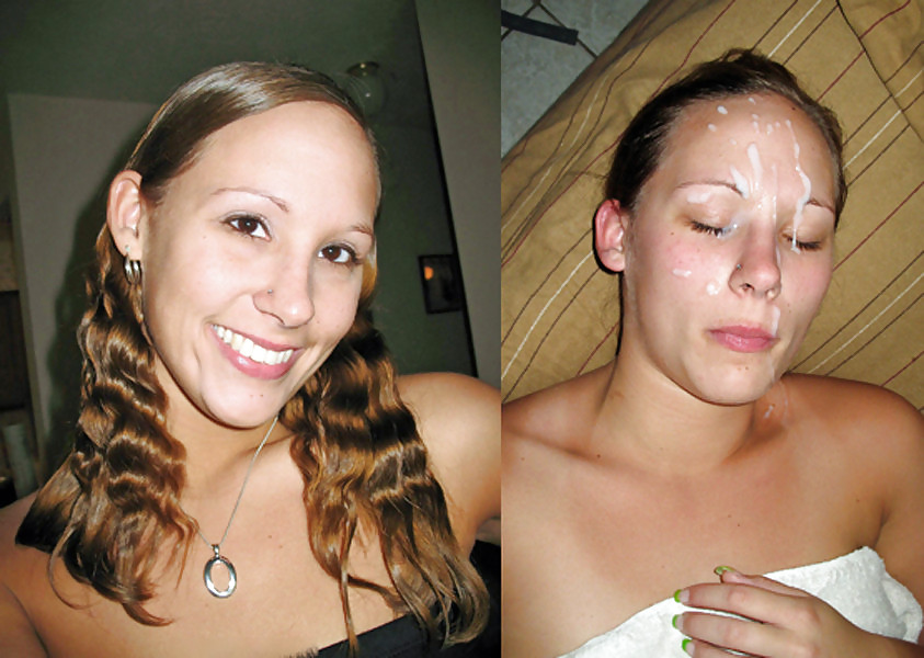 Before And After Facials #23965503