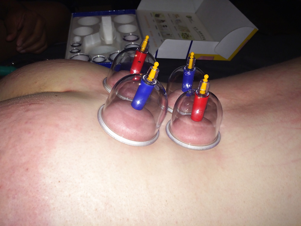 Japanese suction cups massage therapy  #31777190