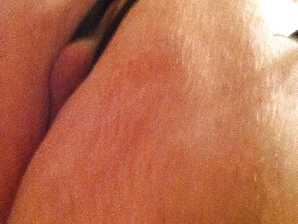 My butt part II #24313079
