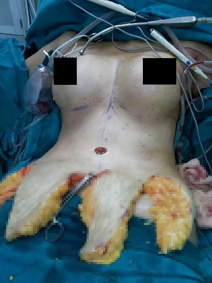 セックスのコツ
 #40386330