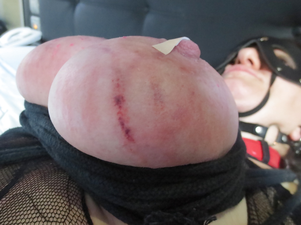 Seni in trattamento
 #32621442