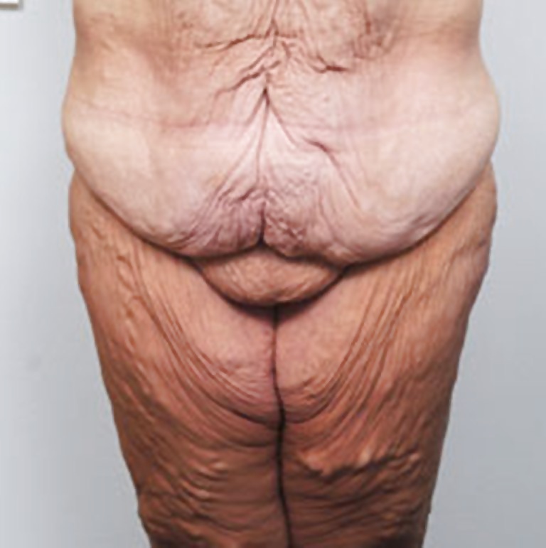 Types of bodies that excite me part 2 #34164605