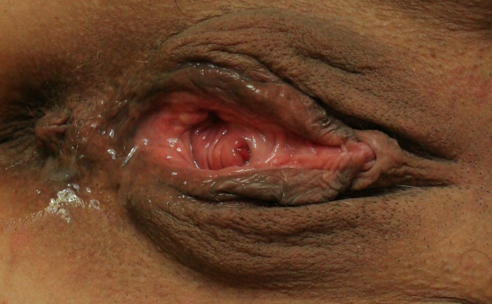 Rosette 24 #31960588