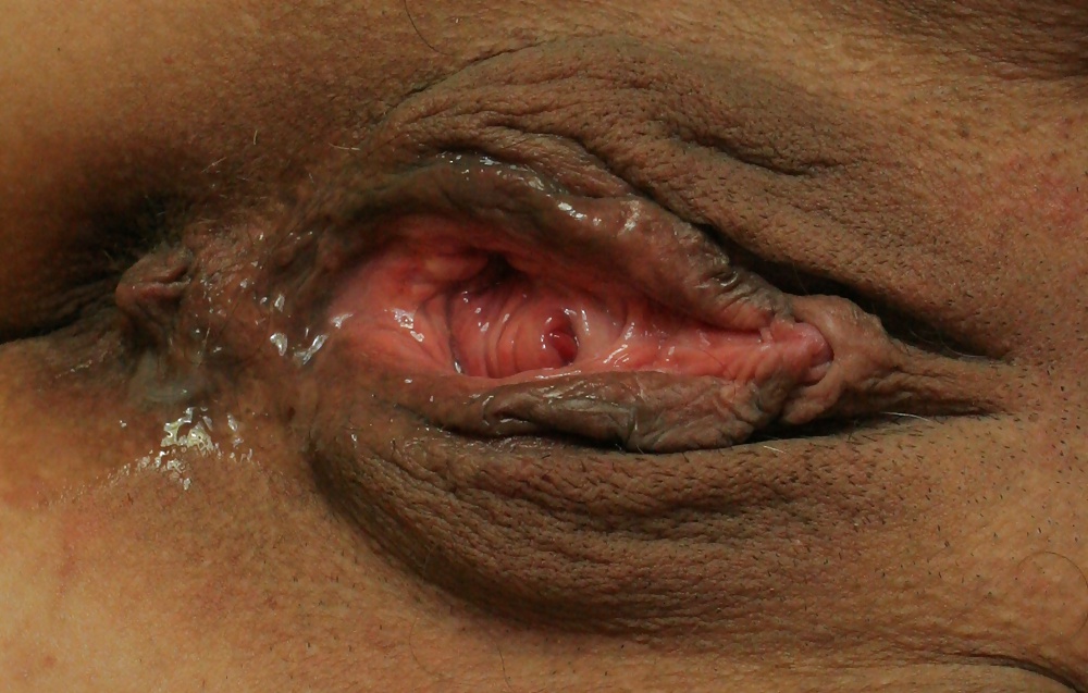 Rosette 24 #31960591