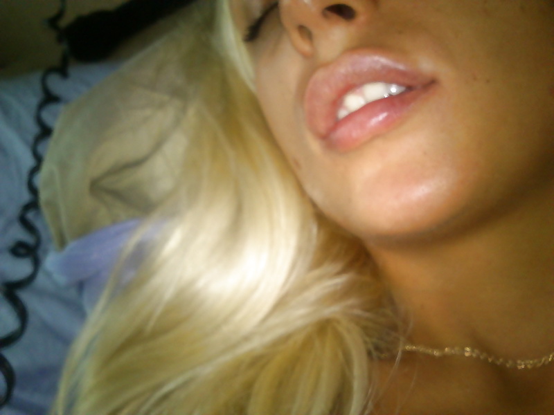 Puta con labios inflados
 #33177685