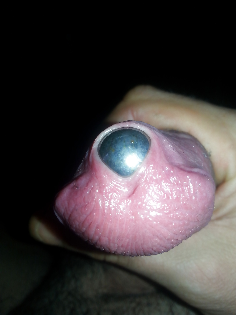 Xxxxxxxxxxxxx
 #31337250