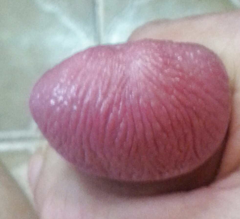 Xxxxxxxxxxxxx
 #31337260