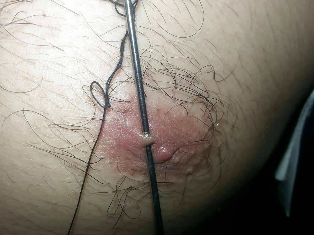 Xxxxxxxxxxxxx
 #31337298