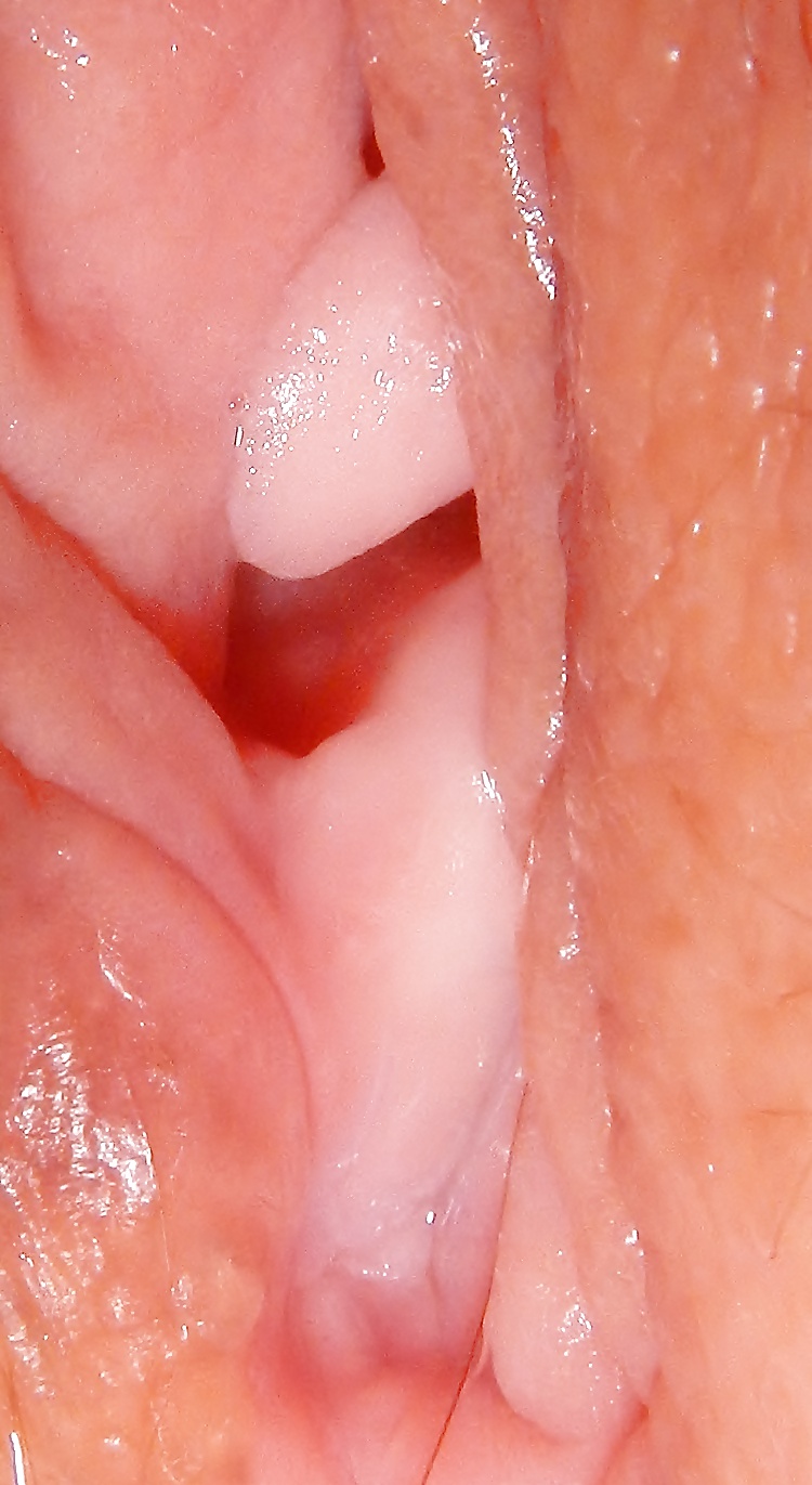 August Set 2 #28144633