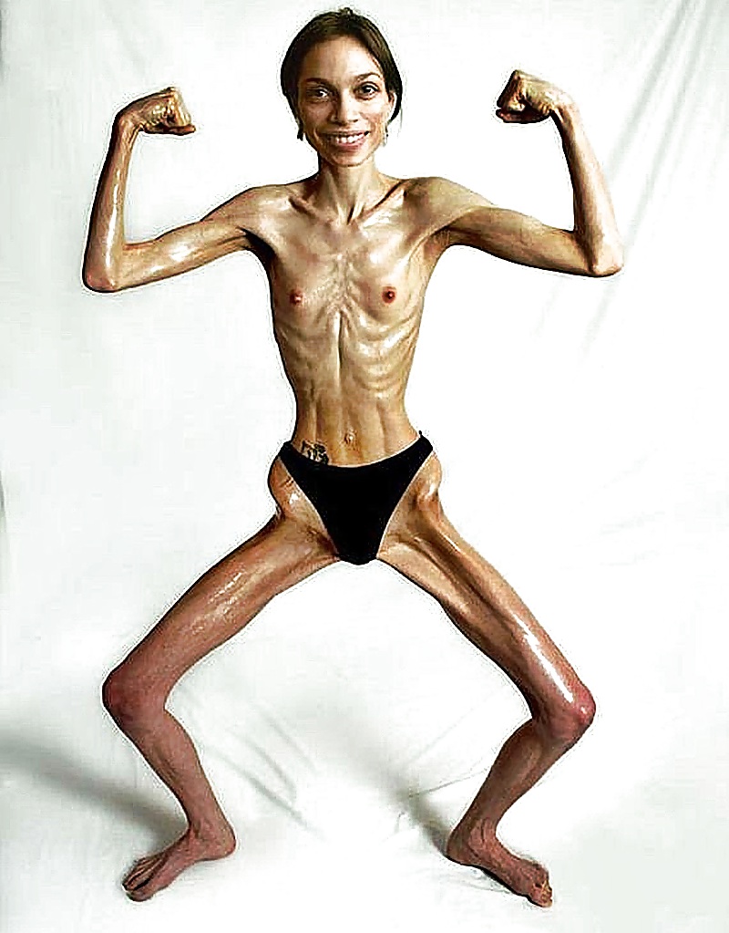 Anoréxica
 #35322963