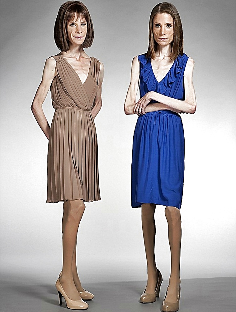 Anoréxica
 #35322974