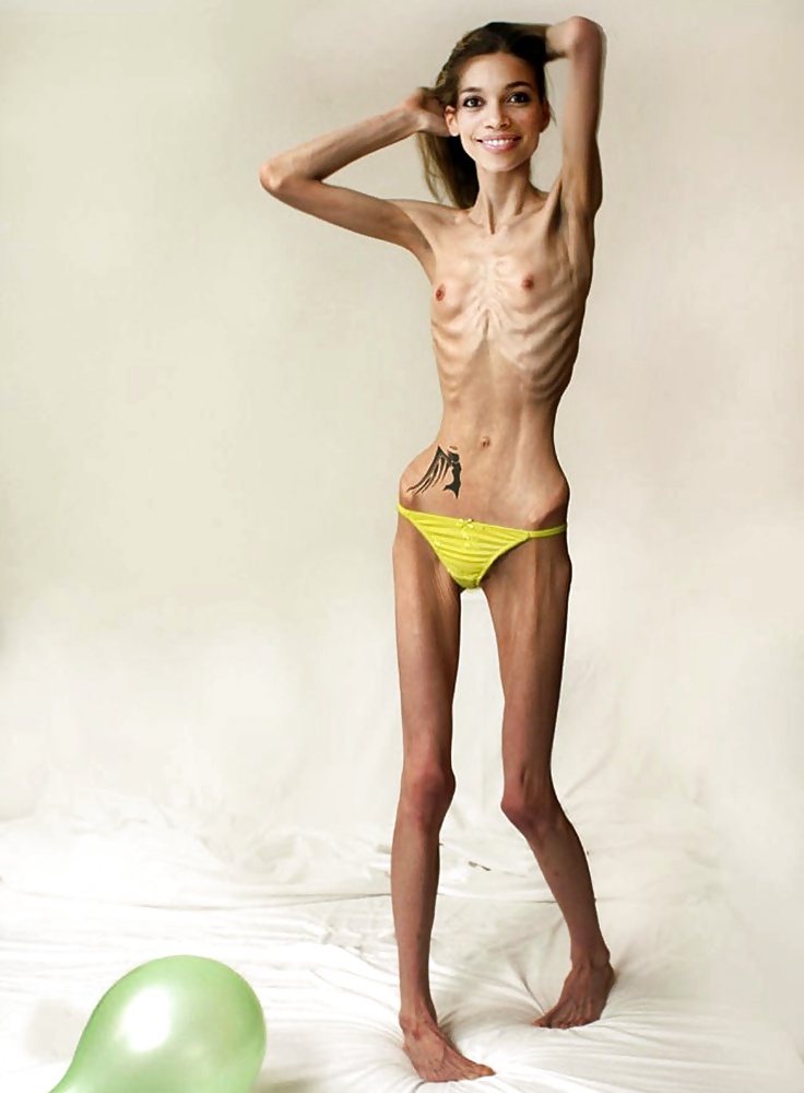 Anoréxica
 #35322987