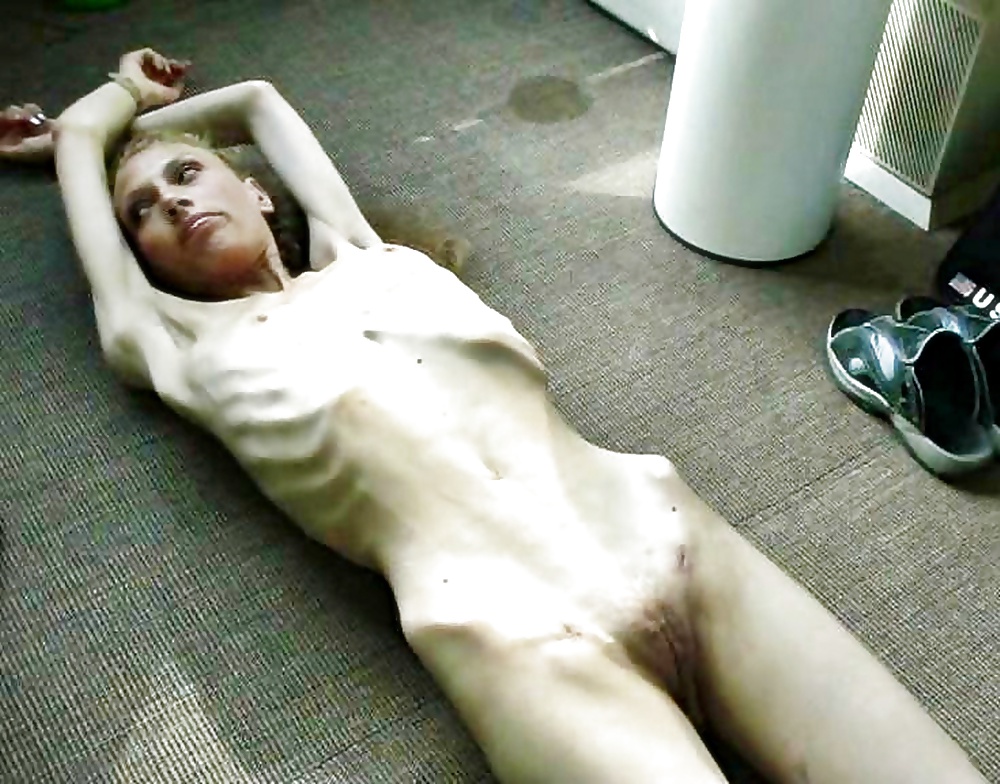 Anoréxica
 #35322996