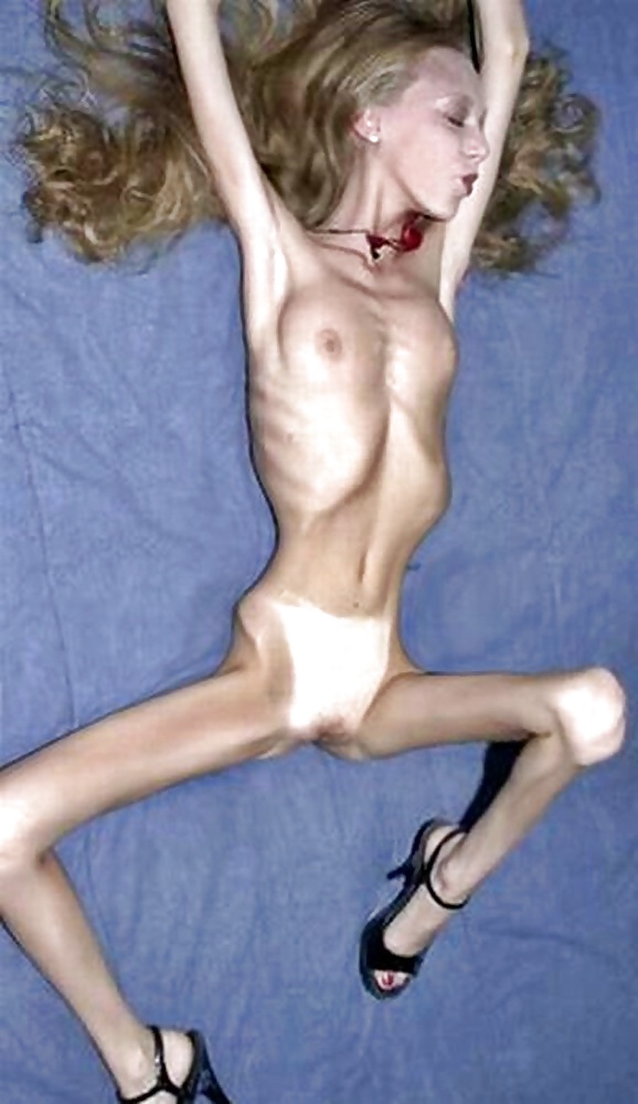 Anoréxica
 #35323010