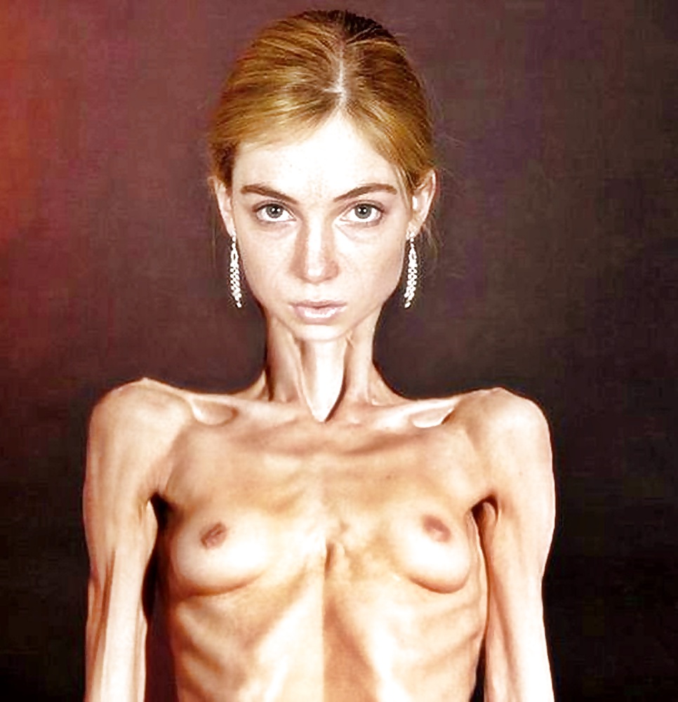 Anoréxica
 #35323017