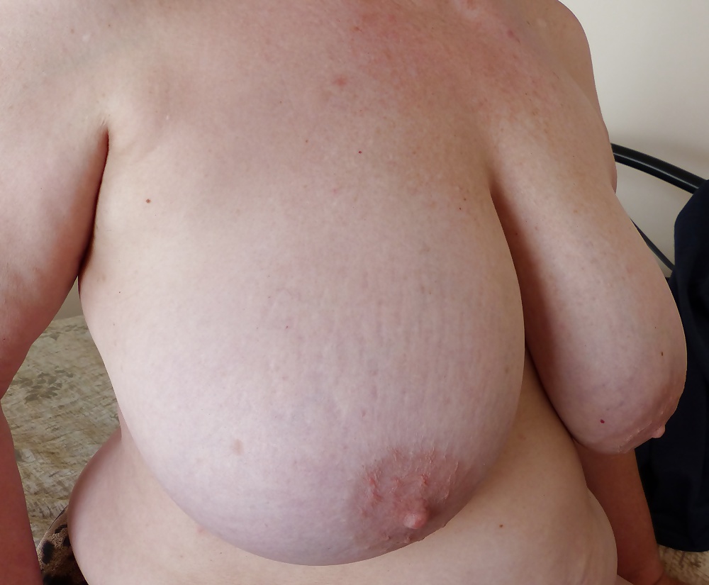 Big tit stretch marks #28023407