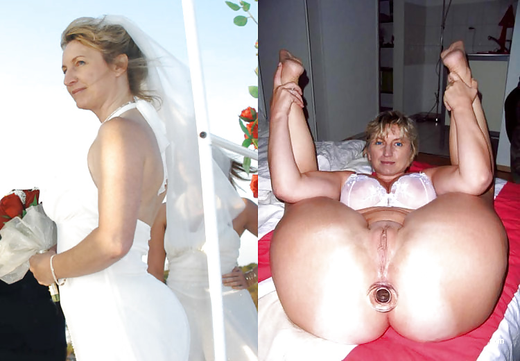 Dressed undressed #40042887
