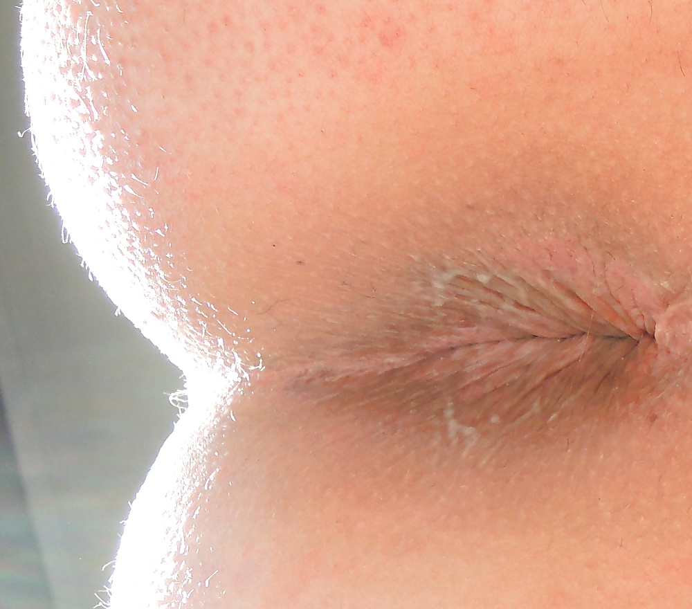 Mixed pics of my butthole from 18 until now #39112379