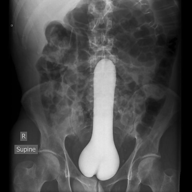 Huge cock xray #25087713