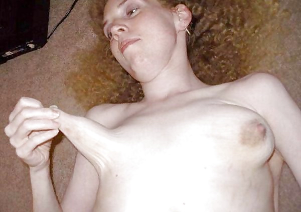 Stretch Marks Empty TITS #31788112