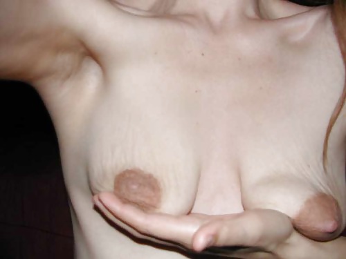 Stretch Marks Empty TITS #31788144