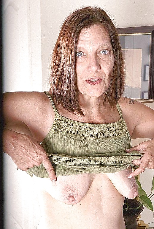 Stretch Marks Empty TITS #31788156