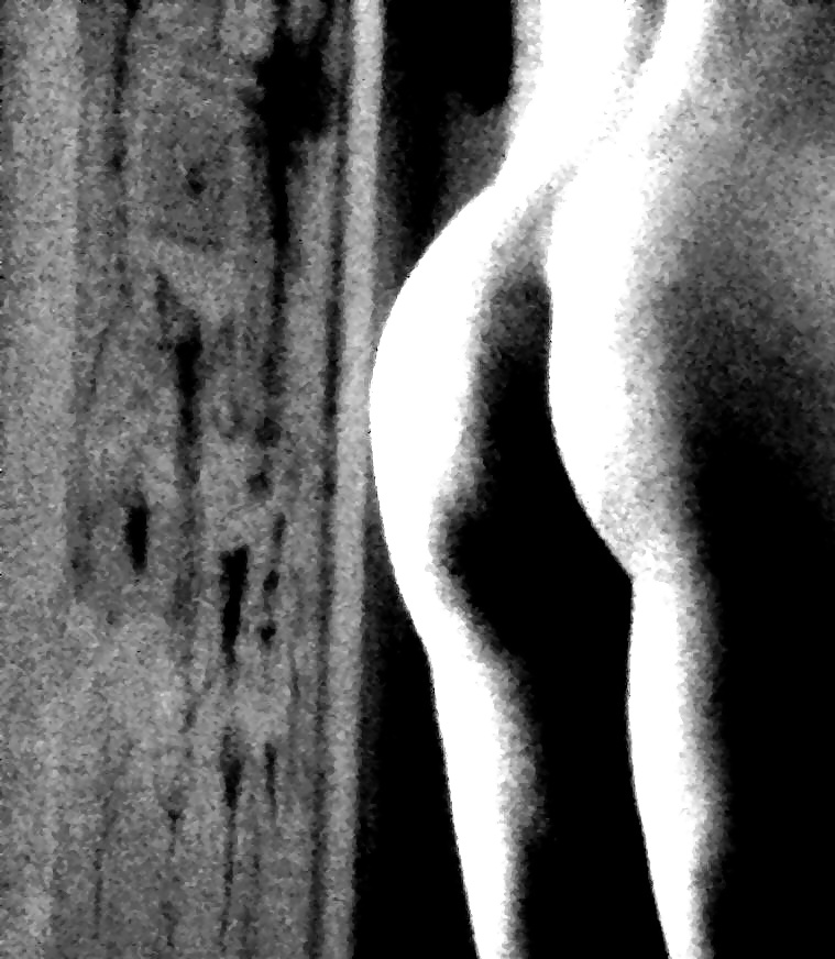 Neue Blickwinkel #37633796