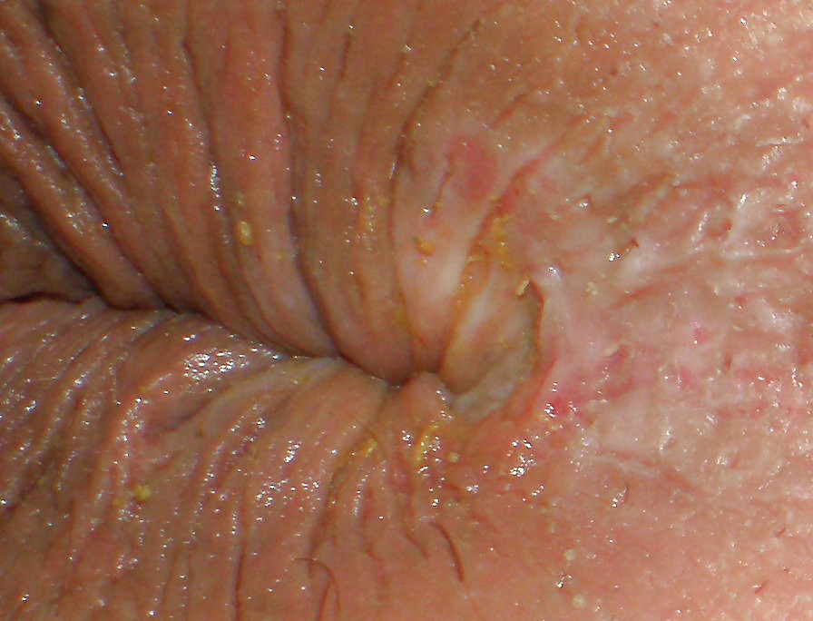 My girlie butthole as 18 y 3 m old #23037885