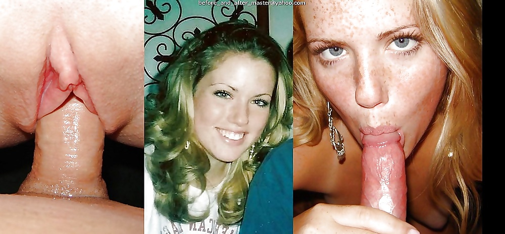 148- before and after 3
 #29094386